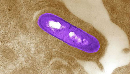invento patente listeria bacteria